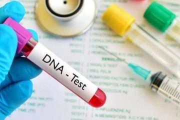Những điều cần biết về giám định ADN